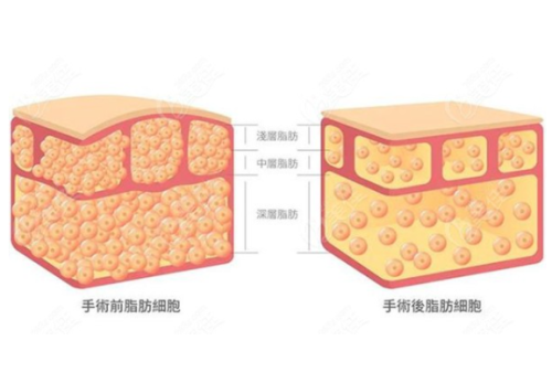 QQ20241014-111556.png