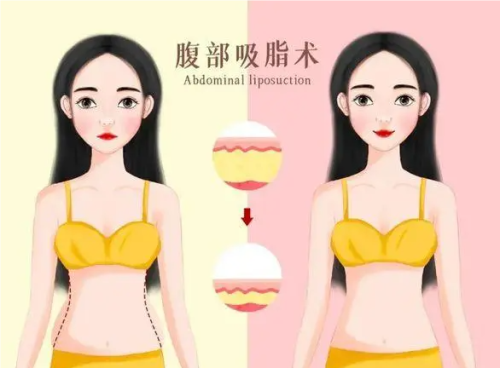 QQ20241014-111700.png