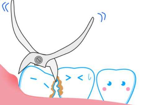 拔智齿.jpg