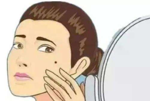 祛痣 祛痣