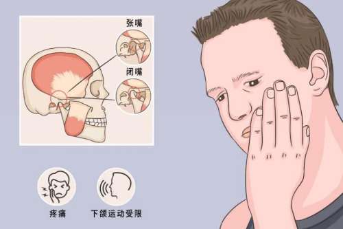 正颌 正颌