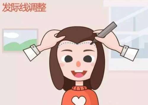发际线.jpg