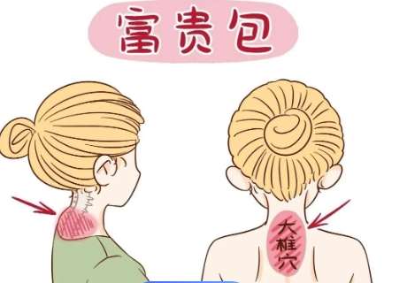富贵包 富贵包