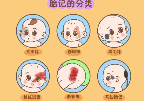 胎记0.jpg
