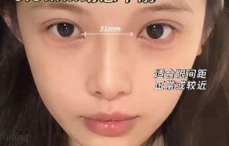 双眼皮 双眼皮