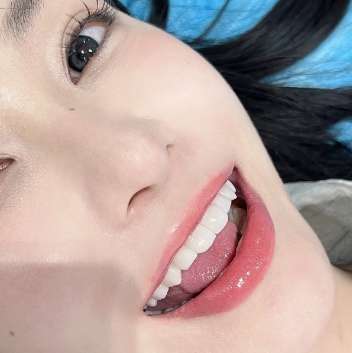 牙齿 牙齿