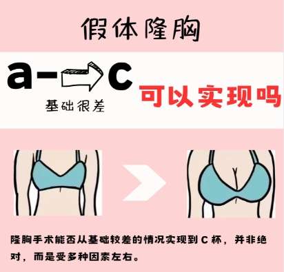 隆胸xx 隆胸xx