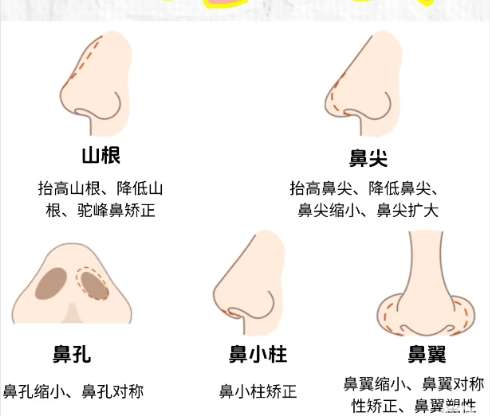 隆鼻xx4.jpg