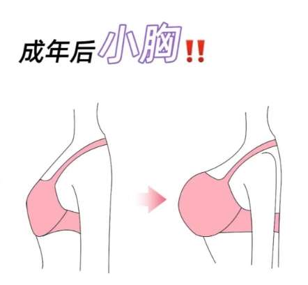 隆胸xx5.jpg