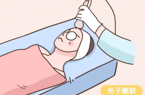 光子嫩肤 光子嫩肤