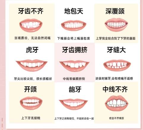 牙齿矫正 牙齿矫正