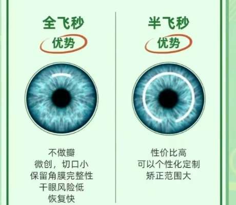近视眼矫正 近视眼矫正