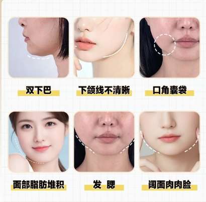 面吸 面吸