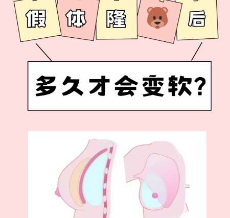 隆胸 隆胸