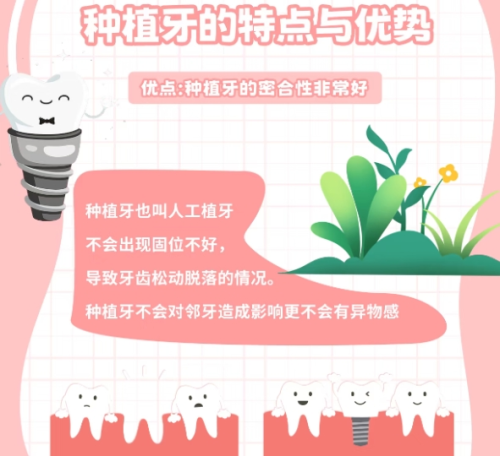种植牙齿 种植牙齿
