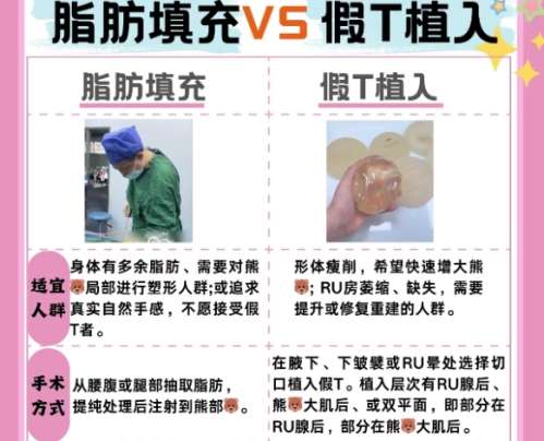 脂肪隆胸 脂肪隆胸