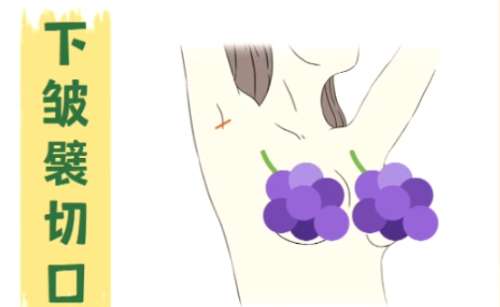 ¡