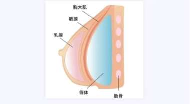 隆胸 隆胸