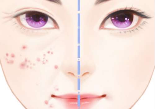 彩光美肤.jpg