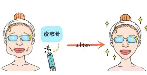 面吸 面吸