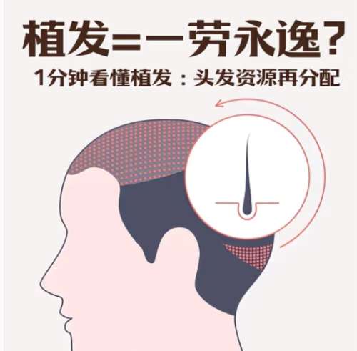 ֲ