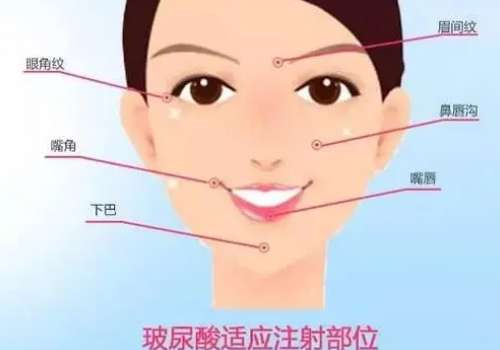 玻尿酸7.jpg