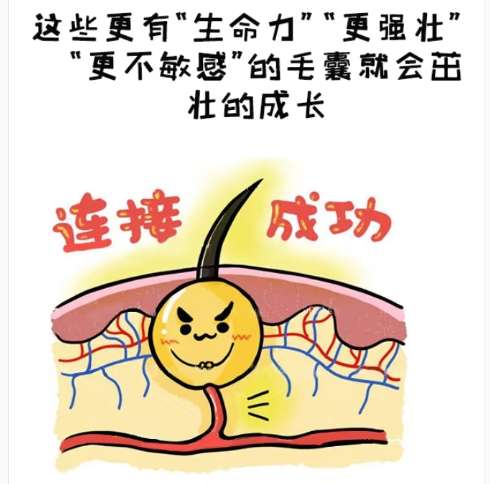 植发 植发