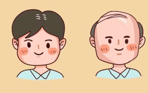 ֲ