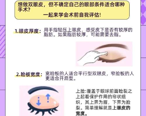 双眼皮 双眼皮