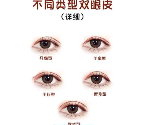 双眼皮 双眼皮