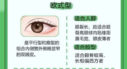 双眼皮 双眼皮