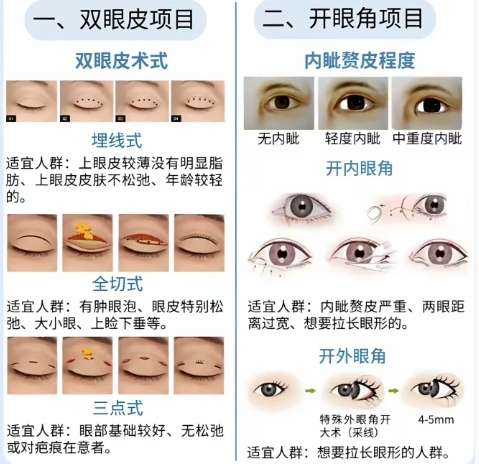 双眼皮 双眼皮