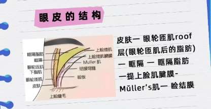 双眼皮 双眼皮