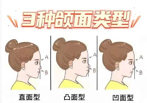 颌面 颌面