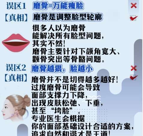 磨骨 磨骨