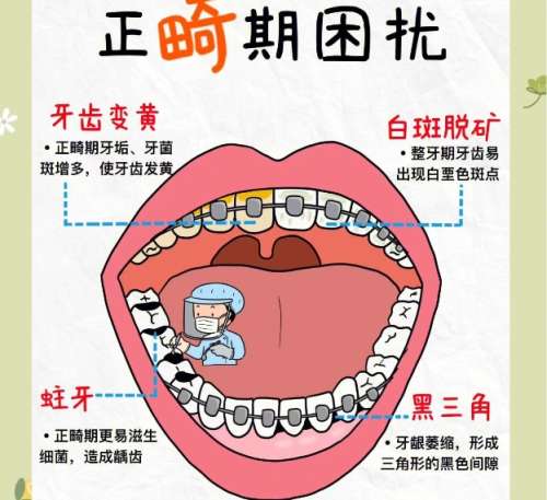牙齿正畸 牙齿正畸