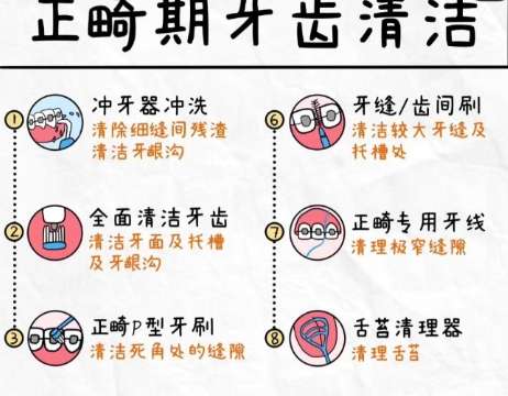 牙齿正畸 牙齿正畸