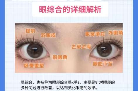 双眼皮 双眼皮