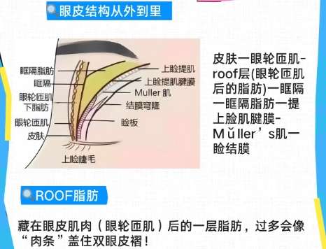 双眼皮 双眼皮