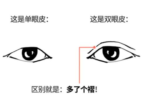 双眼皮1.jpg