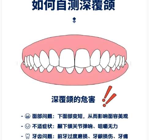 深覆合矫正 深覆合矫正