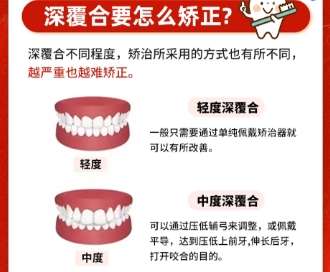 深覆合矫正 深覆合矫正