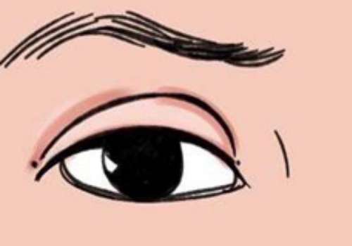 双眼皮肉条.jpg