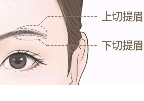 2025ԺüǮ5000Ԫҽ顢ع