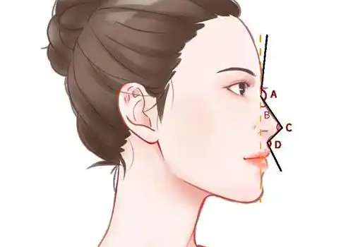 隆鼻.jpg