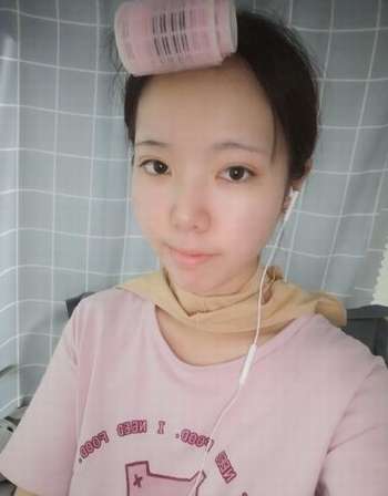 下颌角整形4.jpg