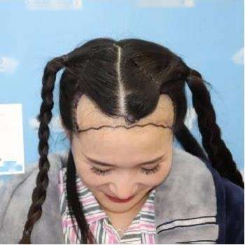 ֲͷŨˣʻ