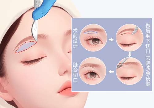 提眉11.jpg