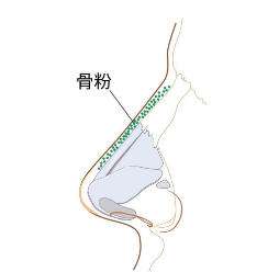 鼻子 鼻子