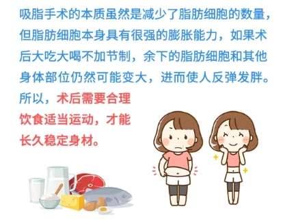 吸脂 吸脂